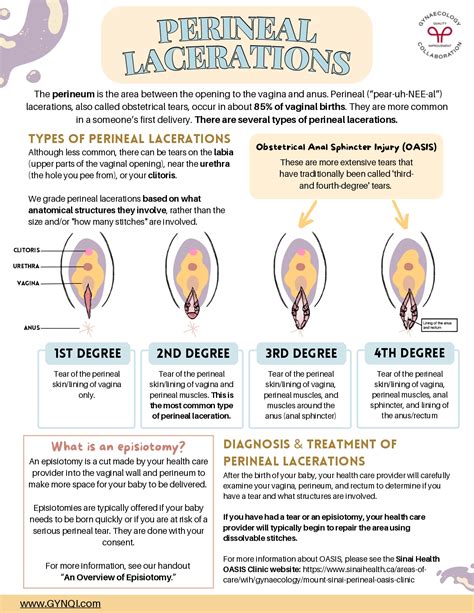 Perineal Lacerations