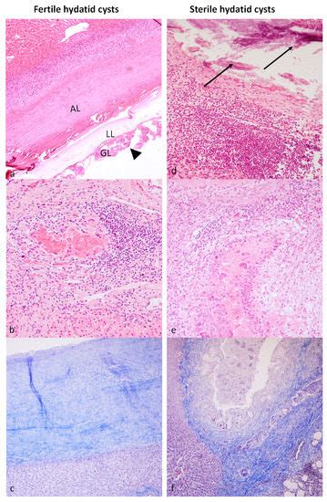 Evaluation of the Local Immune Response to Hydatid Cysts in Sheep Liver