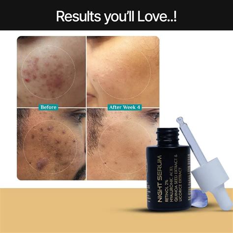 Night Serum (30ml) – Youth Face