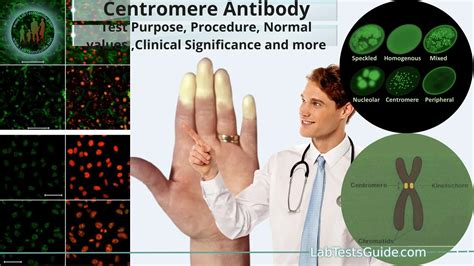 Centromere Antibody Test Purpose, Procedure, Normal values ,Clinical ...