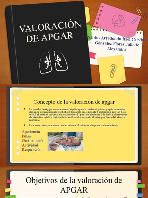 Image result for Que Significa Apgar