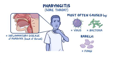 Strep Throat Virus Diagram