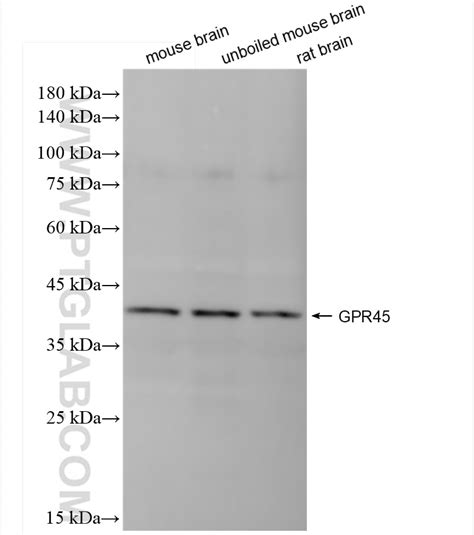 GPR45 antibody (84587-1-RR) | Proteintech