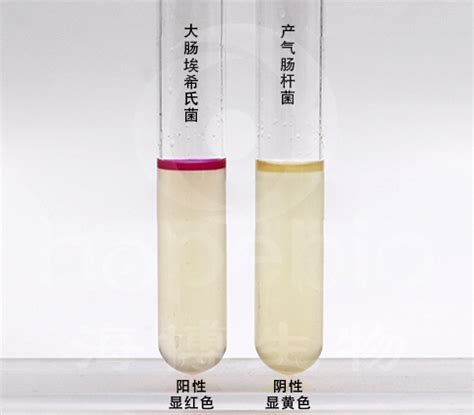 吲哚试验阳性表明细菌能分解吲哚氰绿排泄试验2022已更新今日推荐
