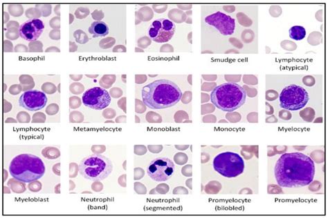 Wbc Differential Count Monocytes High at Marilyn Rose blog