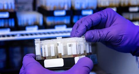 CRL Hanumangarh - Fast Blood Testing Lab | CRL Hanumangarh