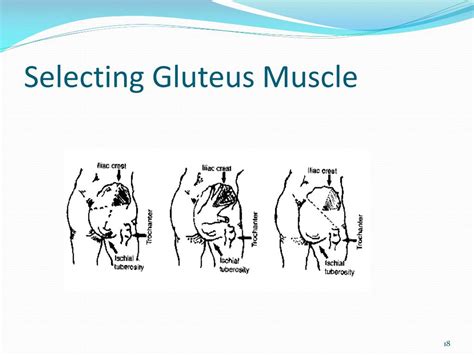 PPT - Intramuscular Injection PowerPoint Presentation, free download ...