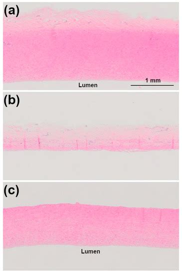 Photocrosslinking of Adventitial Collagen in the Porcine Abdominal ...