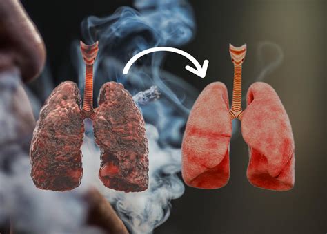 How to Clean Your Lungs After Smoking? Proven Detox Methods for Faster ...