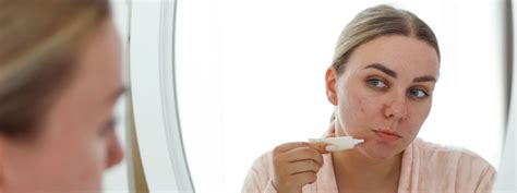 Clear Skin Means: Your Complete Acne Treatment Guide – World of Asaya