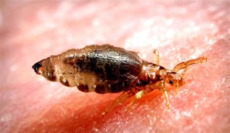 What Does Lice Look Like To The Human Eye at Jasper Saranealis blog