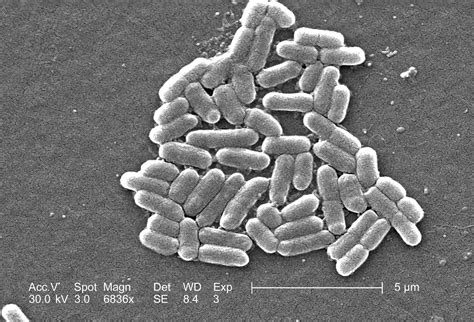 45+ Escherichia coli imágenes gratis