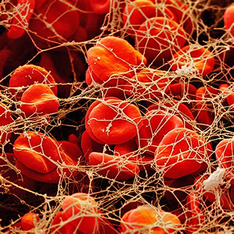 Blood coagulation factors, coagulation cascade, test & coagulation defect