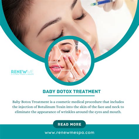 Baby Botox Treatment in Los Angeles | Benefits