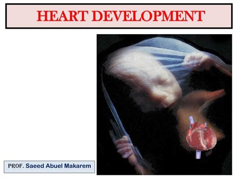 Image result for Heart Development Disorders