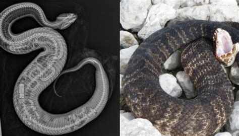 Image result for Python Snake Endoscopy