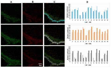 Colocalization Analysis of Cytoplasmic Actin Isoforms Distribution in ...