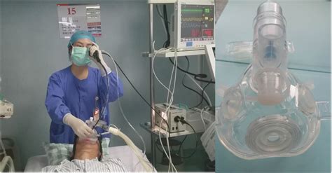 Image result for Difficult Intubation Face