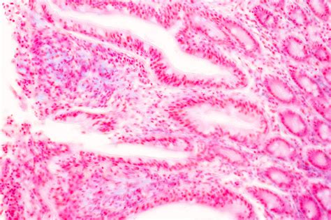 Image result for Jejunum Microscope