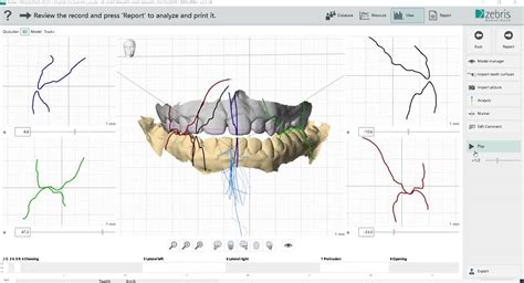 Image result for Modjo Jaw Motion