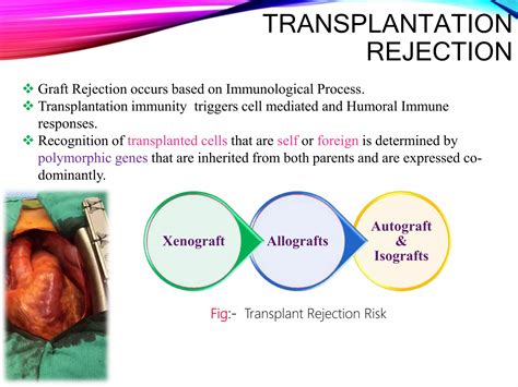 Transplantation | PPTX