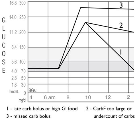 Image result for Pattern Management