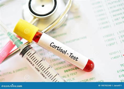 Blood for Cortisol Hormone Test Stock Photo - Image of hypothalamus, checkup: 190702248