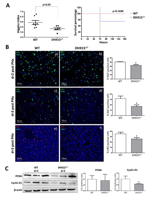 Identification of Dhx15 as a Major Regulator of Liver Development ...