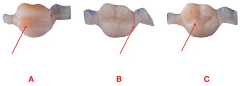 Degradation of a Micro-Hybrid Dental Composite Reinforced with ...