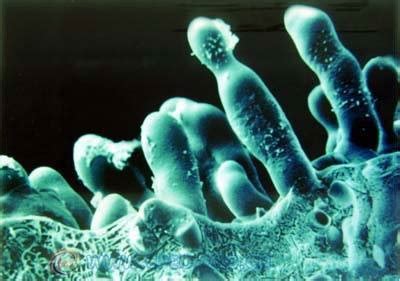 什么是食品中的真菌性污染？-南京微测生物科技有限公司