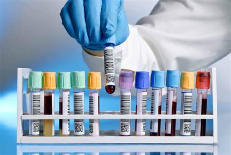 Difference Between Screening and Diagnostic Tests | Mughal Labs