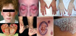 Arthritis | Dr. Sauvik Dasgupta | The Rheuma Clinic