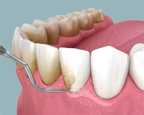 Scientists Found an Unexpected Sign of Human Longevity—Our Teeth