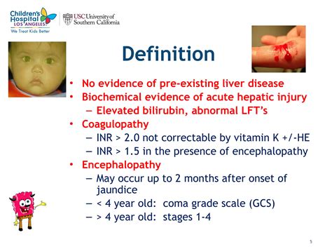 Acute Liver Failure in Children.ppt