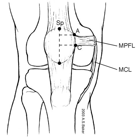 Knee Biomechanics - Recon - Orthobullets