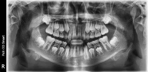 Buy Vatech PaX-i 3D CB CITY Online at Best Prices - ID Enterprises