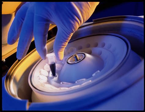 What Centrifugation Is and Why It's Used