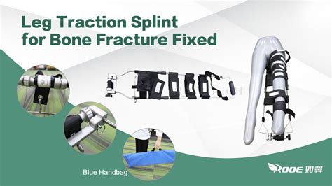 Hare Traction Splint Application 的图像结果