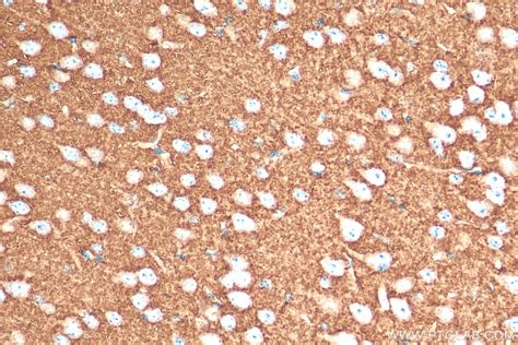 VGLUT2 antibody (29209-1-AP) | Proteintech