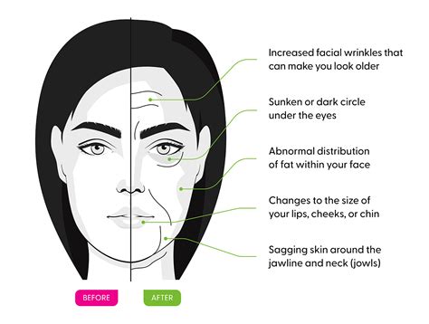 What is Ozempic Face? Can You Avoid It? | Superdrug Online Doctor