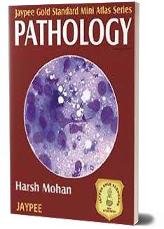 JaypeeDigital | Tuberculous Granulomatous Inflammation