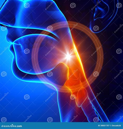 Sore Throat - Flu / Cold / Stuck Throat Stock Illustration ...