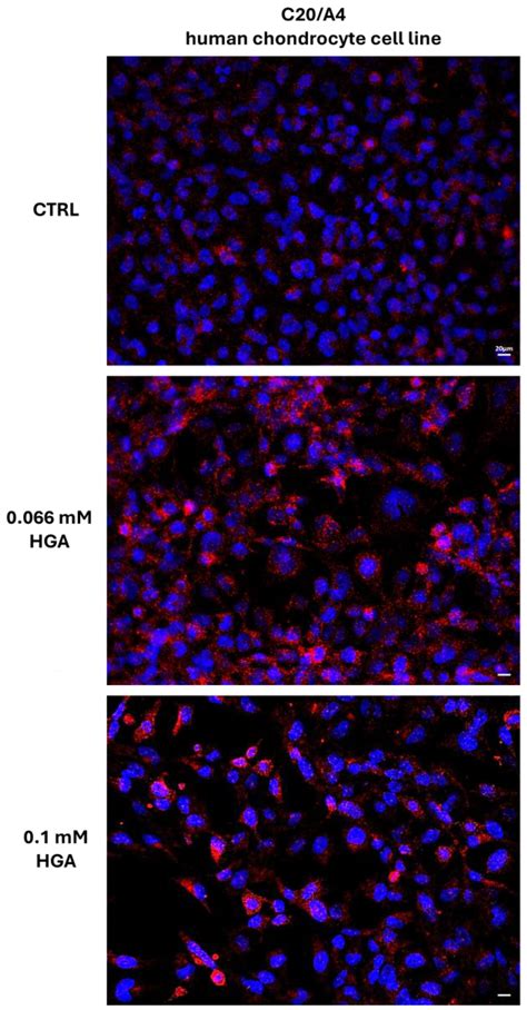 HGA Triggers SAA Aggregation and Accelerates Fibril Formation in the ...