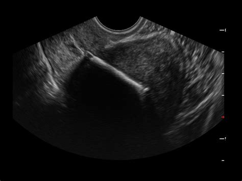 CD25 - Konica Minolta