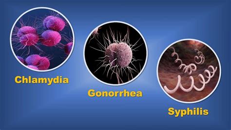 Sexually Transmitted Diseases (STDs) And It's Prevention | Science Vision