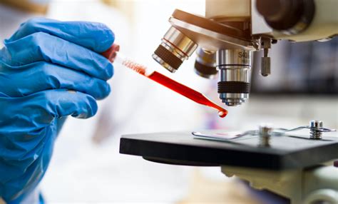 AMU Researchers Find 'Dangerous' Multi-Drug Resistant Bacterial Gene in ...