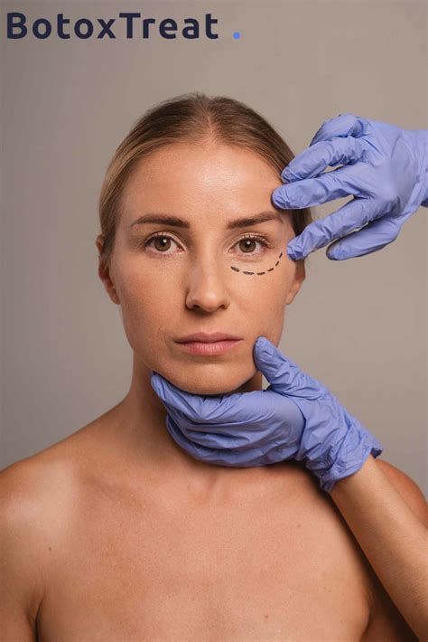 Enhancing Botox Treatment with Complementary Therapies - BotoxTreat