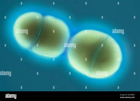 Image result for Enterococcus Faecalis Bacteria Cell Structure