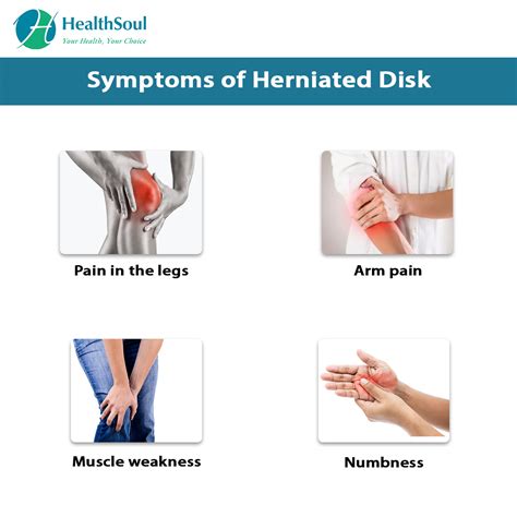 Herniated Disk Symptoms