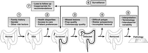 Sessile Serrated Adenomas: An Evidence-Based Guide to Management - Clinical Gastroenterology and ...
